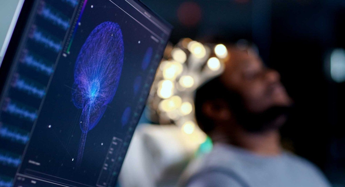 photo of a person receiving an EEG