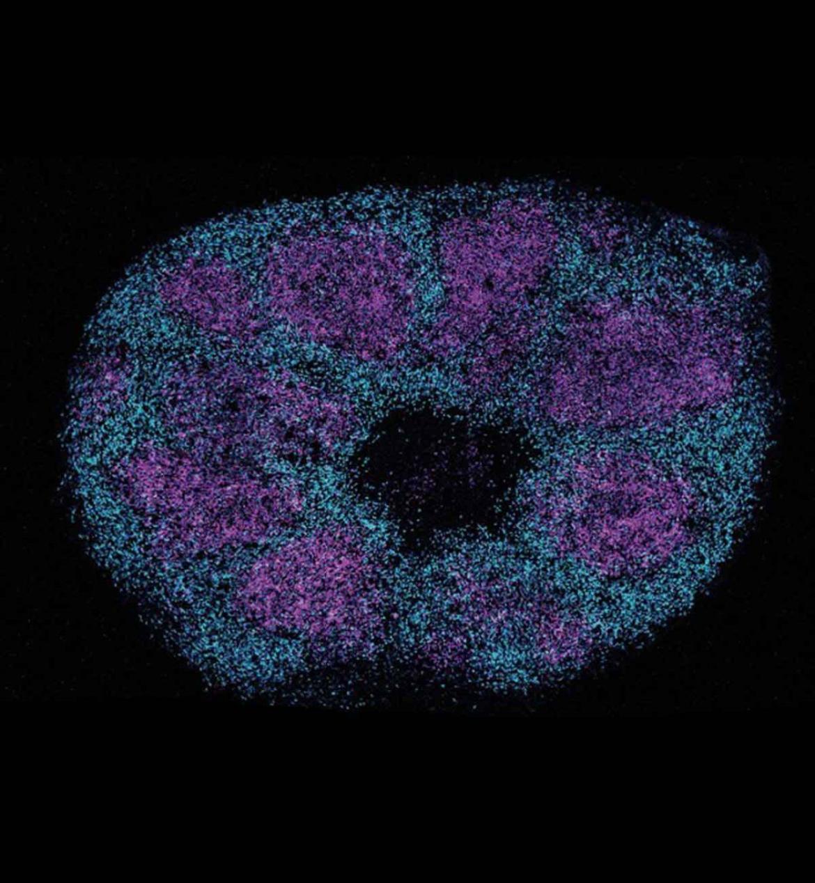 Brain organoid