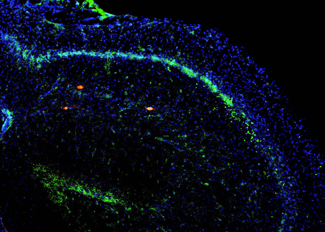 brain-circuit-neurons-in-prefrontal-cortex