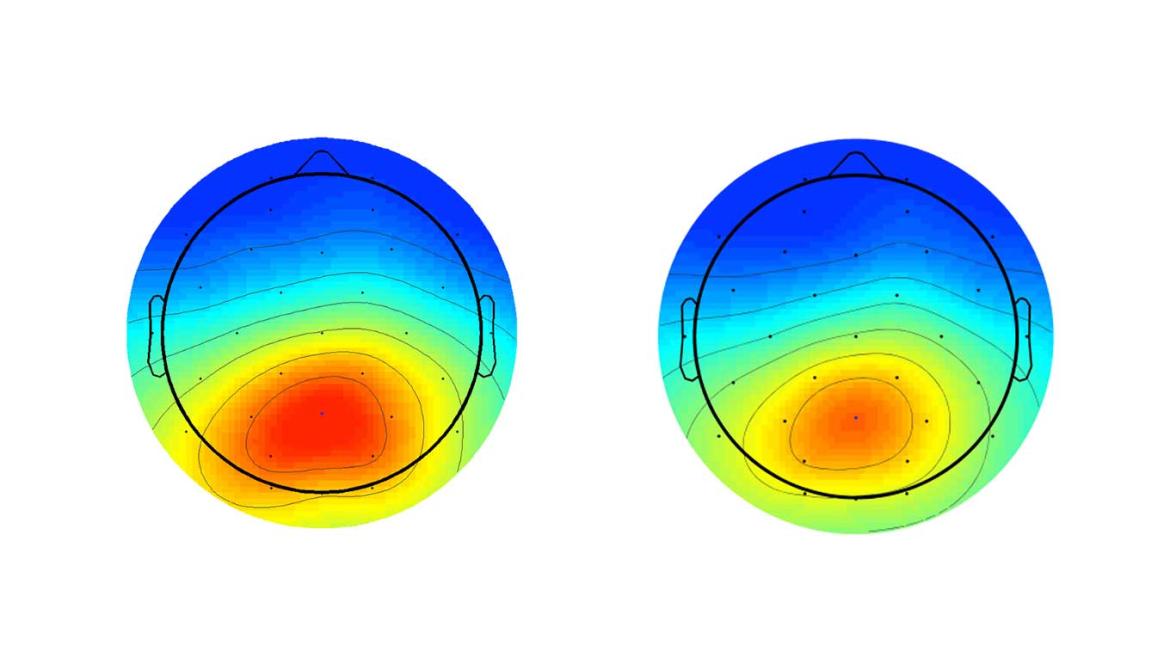 EEG scan of two scalps