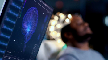 photo of a person receiving an EEG