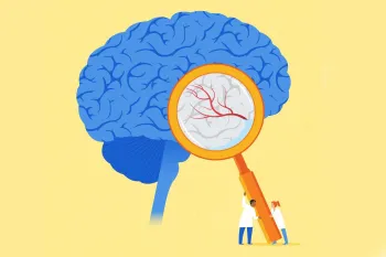 Illustration of a blue brain with doctors using an oversized magnifying glass
