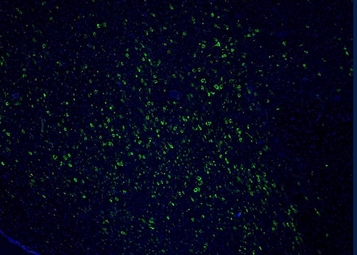 human-histaminergic-neurons