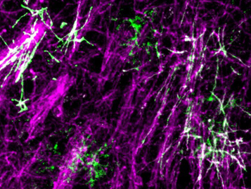 Myelin