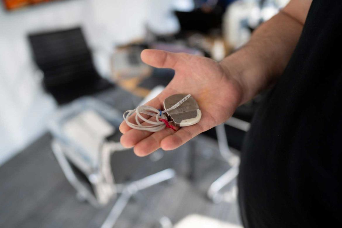 hand holding a deep brain stimulation device in palm