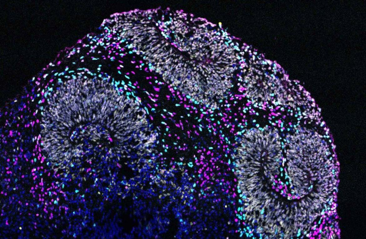 Brain image